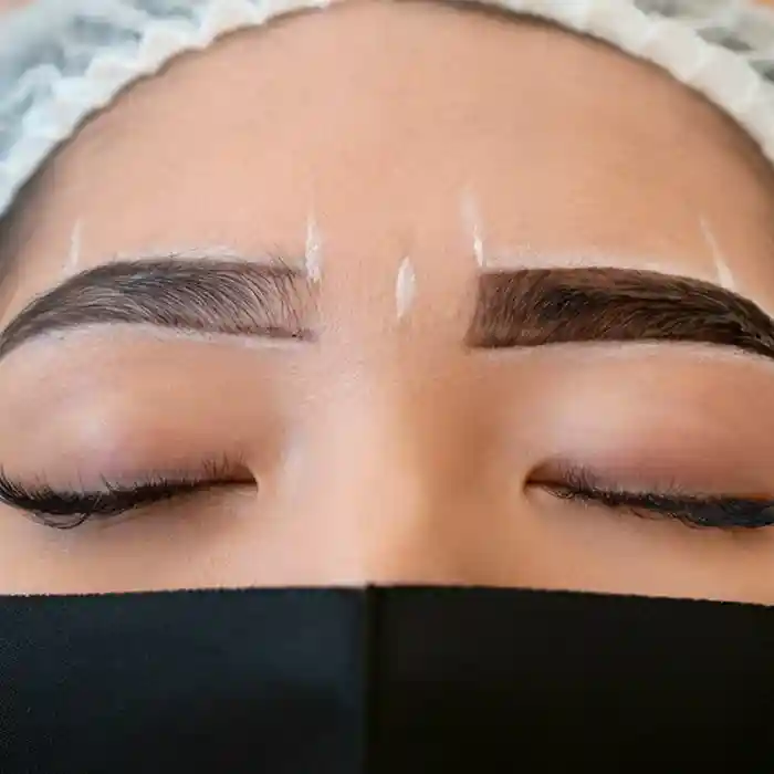 Eyebrow Reconstruction